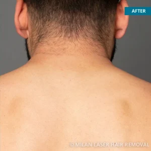 Laser Hair Removal for Feet in London: Tips and Tricks