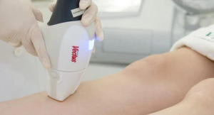 How can laser hair removal help reduce ingrown hairs?